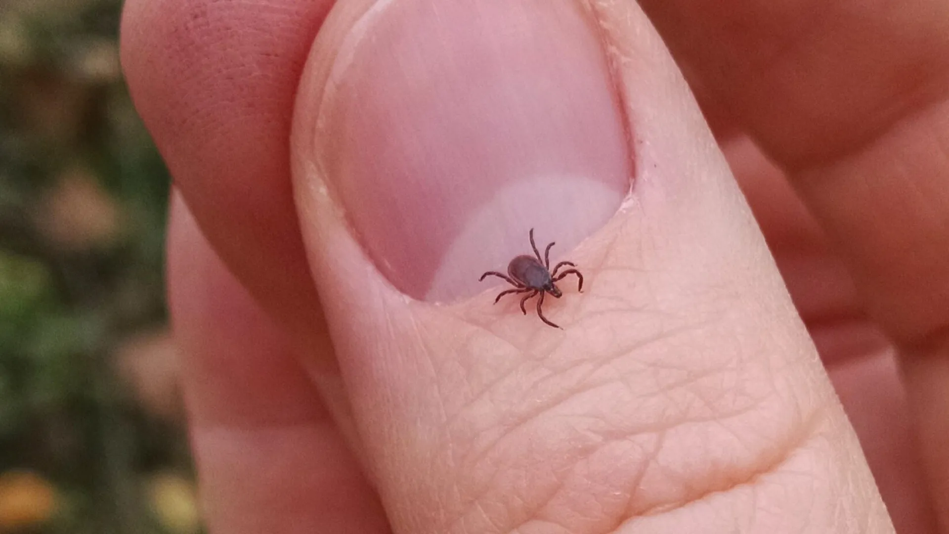 Lyme: La enfermedad que avanza con el cambio clim&aacute;tico